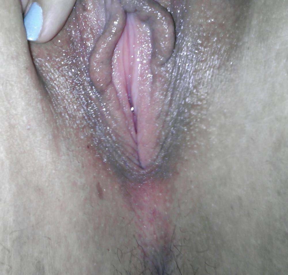 Bilder bravo vulva The Top