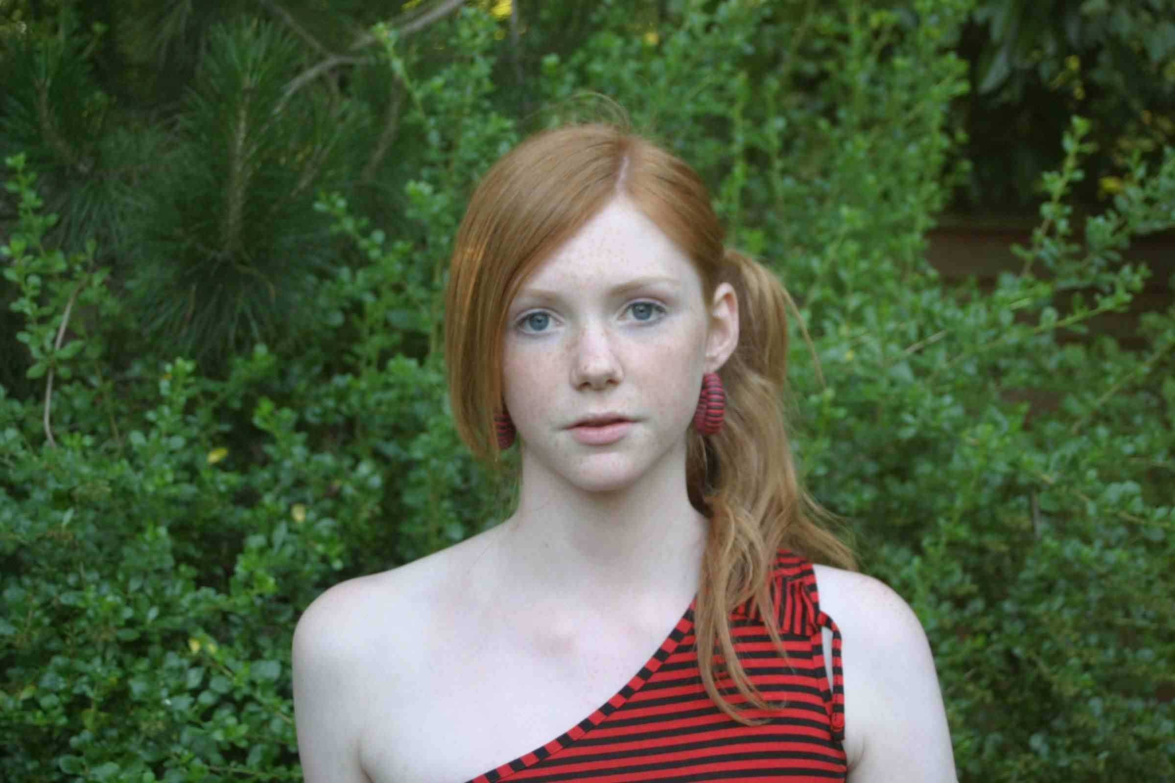 Teen Freckles