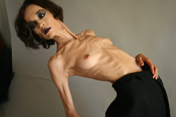 Pictures Of Anorexic Girls Naked